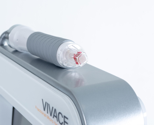 Microneedling met Radio Frequentie